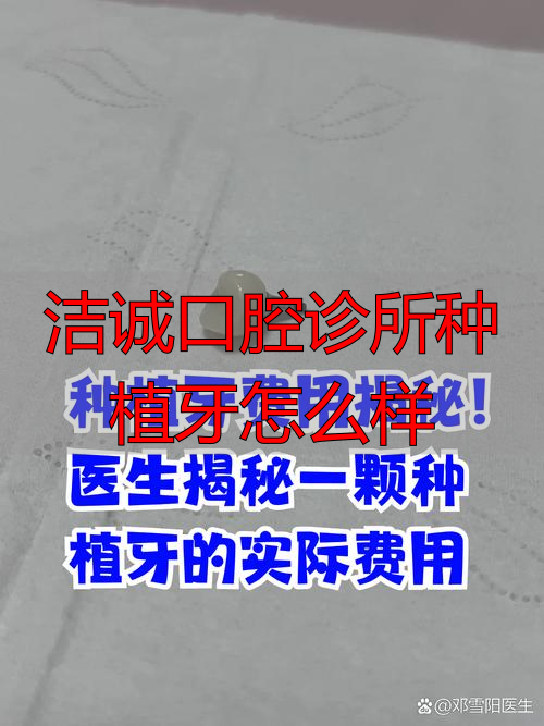 洁诚口腔诊所种植牙怎么样_口腔医院洁牙方式_口腔医院的洁牙是什么意思