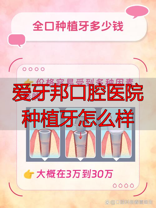 爱牙邦口腔医院种植牙怎么样_口腔种植班_口腔牙科种植牙