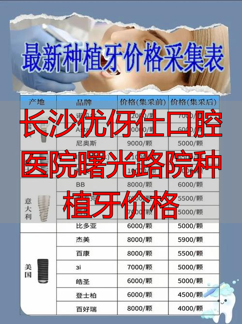 长沙市口腔医院种植牙_曙光医院种牙多少钱_长沙优伢仕口腔医院曙光路院种植牙价格