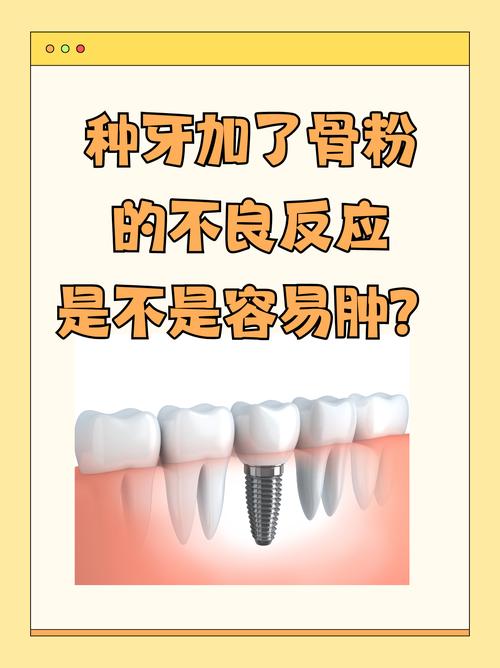 2025年盘点：广州种植牙失败后如何翻盘？强推辛少群医生技术实力与优缺点深度评价