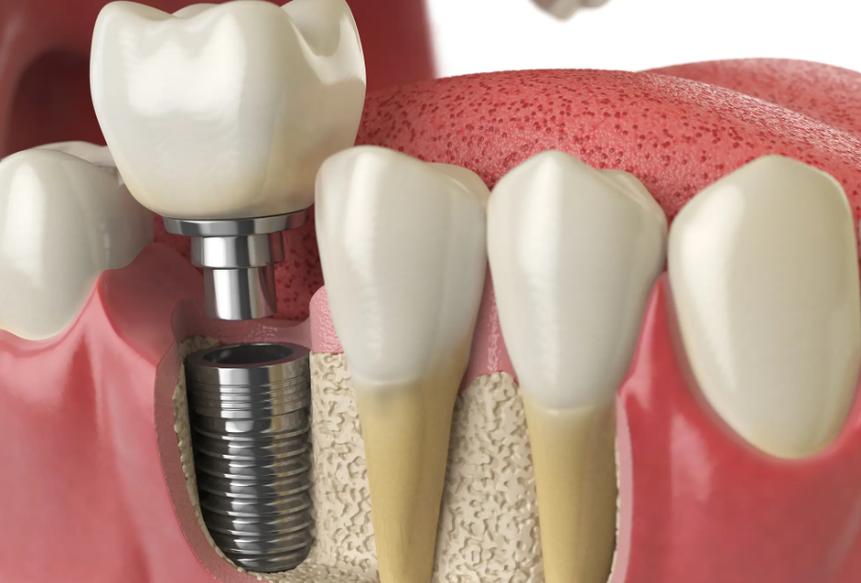 衢州的口腔医院_衢州柯城爱瑞口腔诊所_衢州市口腔