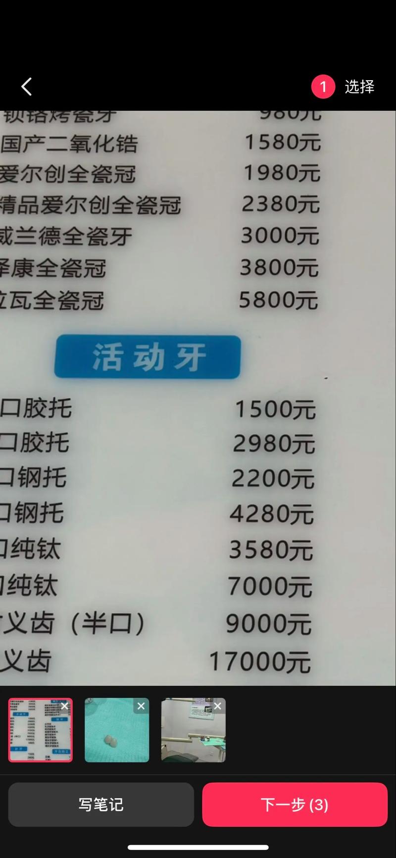 天津爱齿口腔(上谷店)假牙价格_天津全口假牙价目表_天津假牙制作