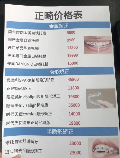 西安圣贝牙科_西安圣贝口腔门诊牙齿矫正价格_西安牙齿矫正诊所