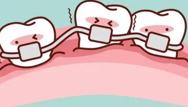 瑞格口腔诊所(河北大街店)假牙价格_爱洁口腔诊所 石家庄爱洁口腔地址 爱洁口腔真实案例